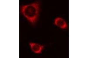 ABIN6277699 staining A549 cells by IF/ICC. (CSTA Antikörper  (C-Term))