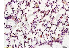 Formalin-fixed and paraffin embedded rat brain tissue labeled with Anti-Synaptotagmin 1/SYT1 Polyclonal Antibody, Unconjugated (ABIN754888) at 1:200 followed by conjugation to the secondary antibody, (SP-0023), and DAB staining (Synaptotagmin Antikörper  (AA 165-260))