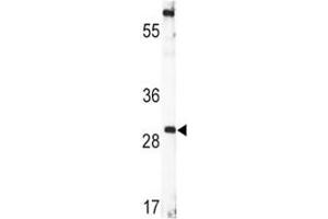 Western blot analysis of BDNF antibody and CEM lysate. (BDNF Antikörper  (AA 206-236))