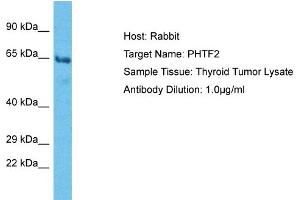 Host: Rabbit Target Name: PHTF2 Sample Type: Thyroid tumor lysates Antibody Dilution: 1.