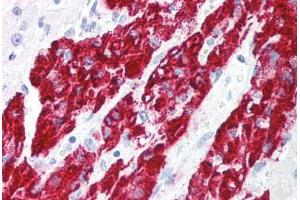 Human Adrenal (formalin-fixed, paraffin-embedded) stained with IER3 antibody ABIN213935 at 5 ug/ml followed by biotinylated goat anti-rabbit IgG secondary antibody ABIN481713, alkaline phosphatase-streptavidin and chromogen. (IER3 Antikörper  (Internal Region))
