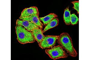 Immunocytochemistry (ICC) image for anti-Phospholipase D2 (PLD2) (AA 834-933) antibody (ABIN5881791) (Phospholipase D2 Antikörper  (AA 834-933))