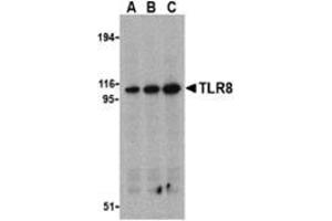Western blot analysis of TLR8 in Daudi cell lysates with this product at (A) 0. (TLR8 Antikörper  (Middle Region))