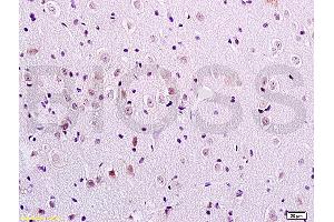 Formalin-fixed and paraffin embedded rat brain tissue labeled with Anti-FOXC1/FREAC3 Polyclonal Antibody, Unconjugated (ABIN719291) at 1:200 followed by conjugation to the secondary antibody and DAB staining