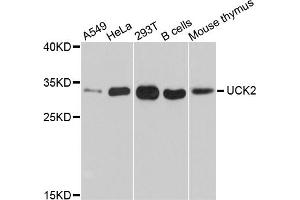 Western blot analysis of extracts of various cell lines, using UCK2 antibody (ABIN5999140) at 1/1000 dilution. (UCK2 Antikörper)