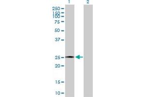 Western Blot analysis of AMELX expression in transfected 293T cell line by AMELX MaxPab polyclonal antibody. (AMELX Antikörper  (AA 1-191))