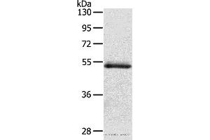 Western blot analysis of Human normal colon sigmoideum tissue, using OLFM4 Polyclonal Antibody at dilution of 1:200