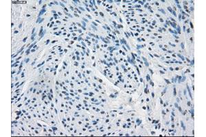 Immunohistochemical staining of paraffin-embedded endometrium tissue using anti-FHmouse monoclonal antibody. (FH Antikörper)