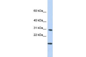 WB Suggested Anti-POLR2K Antibody Titration:  0. (POLR2K Antikörper  (Middle Region))