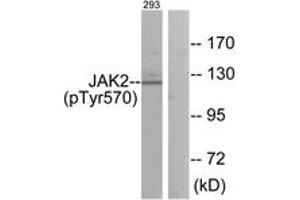 Western blot analysis of extracts from 293 cells treated with etoposide 25uM 24h, using JAK2 (Phospho-Tyr570) Antibody. (JAK2 Antikörper  (pTyr570))