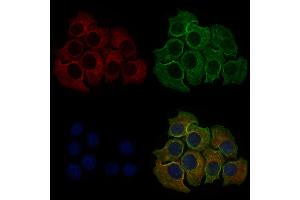 ABIN6257434 and ABIN6273695 staining Hela cells by IF/ICC. (PLCE1 Antikörper  (C-Term))