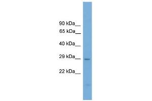 WB Suggested Anti-Prrx2 Antibody Titration:  0. (PRRX2 Antikörper  (Middle Region))