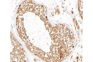 ABIN6266593 at 1/100 staining human testis tissue sections by IHC-P. (MMP16 Antikörper  (C-Term))