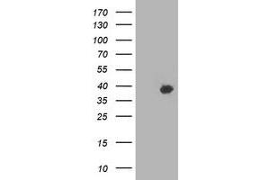 Western Blotting (WB) image for anti-HSPA Binding Protein, Cytoplasmic Cochaperone 1 (HSPBP1) antibody (ABIN1498758) (HSPBP1 Antikörper)