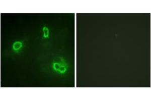 Immunofluorescence analysis of COS7 cells, using p90 RSK (Ab-573) Antibody. (RPS6KA3 Antikörper  (AA 539-588))
