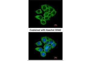 ICC/IF Image Immunofluorescence analysis of methanol-fixed A431, using EEF1D, antibody at 1:200 dilution. (EEF1D Antikörper)