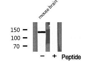 Western blot analysis of MEKKK 4 expression in mouse brain lysate (MAP4K4 Antikörper  (Internal Region))