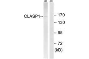 Western blot analysis of extracts from Jurkat cells, using CLASP1 Antibody. (CLASP1 Antikörper  (AA 1171-1220))