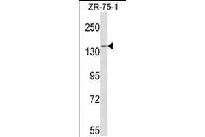 Western blot analysis in ZR-75-1 cell line lysates (35ug/lane). (PAN2 Antikörper  (C-Term))