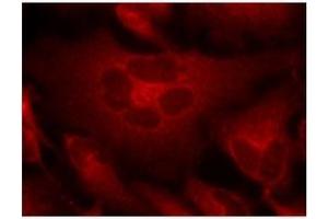 Image no. 1 for anti-Breakpoint Cluster Region (BCR) (Tyr177) antibody (ABIN197420) (BCR Antikörper  (Tyr177))