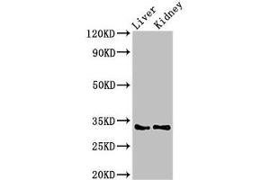 Western Blot Positive WB detected in: Rat liver tissue, Mouse kidney tissue All lanes: HEXIM2 antibody at 3 μg/mL Secondary Goat polyclonal to rabbit IgG at 1/50000 dilution Predicted band size: 33 kDa Observed band size: 33 kDa (HEXIM2 Antikörper  (AA 1-286))