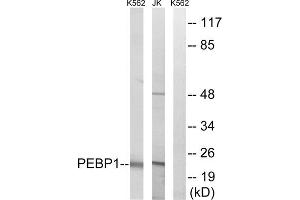 Western blot analysis of extracts from K562 cells and Jurkat cells, using PEBP1 antibody. (PEBP1 Antikörper  (Internal Region))