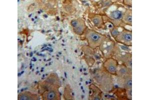 Used in DAB staining on fromalin fixed paraffin-embedded Liver tissue (Interferon gamma Antikörper  (AA 24-166))