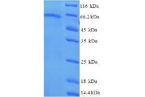 SDS-PAGE (SDS) image for Tubulin, beta 6 (TUBb6) (AA 1-446), (full length) protein (His-SUMO Tag) (ABIN5711879) (TUBb6 Protein (AA 1-446, full length) (His-SUMO Tag))