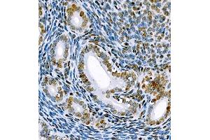 Immunohistochemistry of paraffin embedded mouse uterus using SRRM2 (ABIN7075555) at dilution of 1:650 (400x lens)