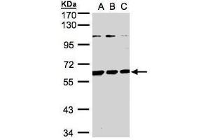 WB Image Sample(30 ug whole cell lysate) A:H1299 B:HeLa S3, C:Hep G2 , 7. (BIVM Antikörper  (C-Term))