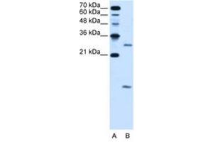 Image no. 2 for anti-Vacuolar H+-ATPase Homolog (VMA21) (N-Term) antibody (ABIN205060)