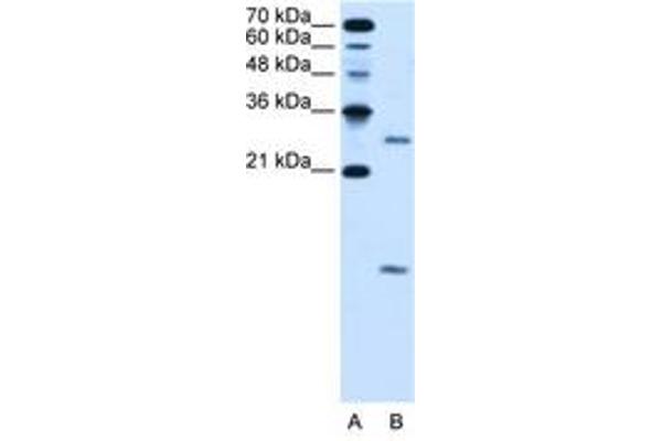 VMA21 anticorps  (N-Term)