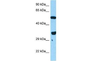 Host:  Mouse  Target Name:  FOXL1  Sample Tissue:  Mouse Skeletal Muscle  Antibody Dilution:  1ug/ml (FOXL1 Antikörper  (N-Term))