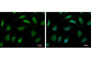 ICC/IF Image hnRNP R antibody [N1N2], N-term detects hnRNP R protein at nucleus and cytoplasm by immunofluorescent analysis.