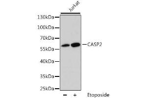 Western blot analysis of extracts of Jurkat cells, using CASP2 antibody. (Caspase 2 Antikörper  (AA 153-452))