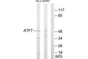 Western blot analysis of extracts from HeLa/HuvEc cells, using ATF7 Antibody.