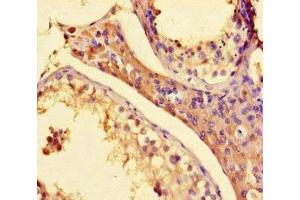 Immunohistochemistry of paraffin-embedded human testis tissue using ABIN7155509 at dilution of 1:100 (SETD1A Antikörper  (AA 188-304))