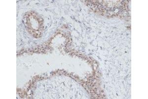 Immunohistochemistry of paraffin-embedded Human breast using NOL3 Polyclonal Antibody at dilution of 1:100 (40x lens).