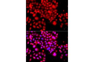 Immunofluorescence analysis of A549 cells using ASCC3 antibody. (ASCC3 Antikörper)