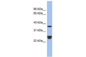 OAZ2 antibody used at 1 ug/ml to detect target protein. (OAZ2 Antikörper  (Middle Region))