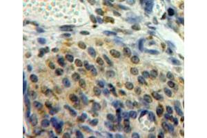Used in DAB staining on fromalin fixed paraffin-embedded ovary tissue (EGR2 Antikörper  (AA 147-403))