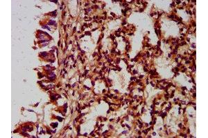 IHC image of ABIN7165873 diluted at 1:400 and staining in paraffin-embedded human lung tissue performed on a Leica BondTM system. (NLRC5 Antikörper  (AA 95-208))