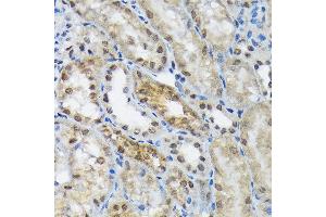 Immunohistochemistry of paraffin-embedded mouse kidney using eIF2B epsilon (EIF2B5) (EIF2B5) Rabbit mAb (ABIN7267038) at dilution of 1:100 (40x lens).