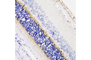 Immunohistochemistry of paraffin-embedded rat retina using  antibody (ABIN6129704, ABIN6136903, ABIN6136905 and ABIN6216979) at dilution of 1:200 (40x lens). (Anoctamin 2 Antikörper  (AA 1-200))
