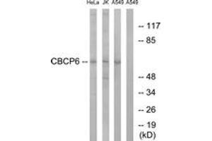 Western Blotting (WB) image for anti-ATP/GTP Binding Protein-Like 4 (AGBL4) (AA 431-480) antibody (ABIN2890251) (AGBL4 Antikörper  (AA 431-480))