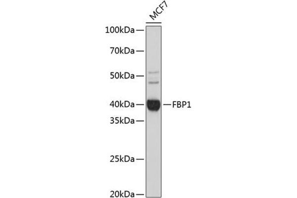 FBP1 抗体