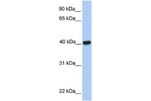 WB Suggested Anti-MGC29891 Antibody Titration:  0. (GABPB2 Antikörper  (C-Term))