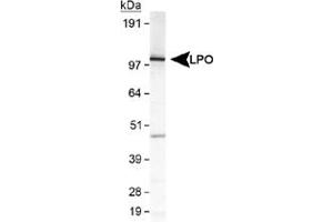 Western blot analysis of LPO in MDA-MB-231 cell lysate using LPO polyclonal antibody . (LPO Antikörper  (AA 650-712))