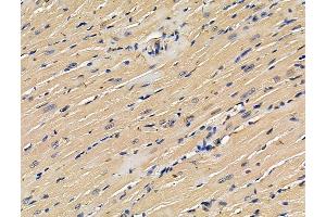 ABIN7096260 and ABIN7100322 at 1/100 staining mouse heart tissue by IHC-P. (Ubiquinol-Cytochrome C Reductase Complex Chaperone (UQCC) Antikörper)