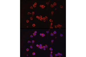 Immunofluorescence analysis of Jurkat cells using NF Rabbit pAb (ABIN3022100, ABIN3022101, ABIN3022102 and ABIN6218604) at dilution of 1:100 (40x lens). (NFATC1 Antikörper  (AA 20-300))